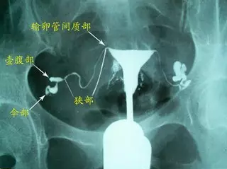重庆送子鸟医院