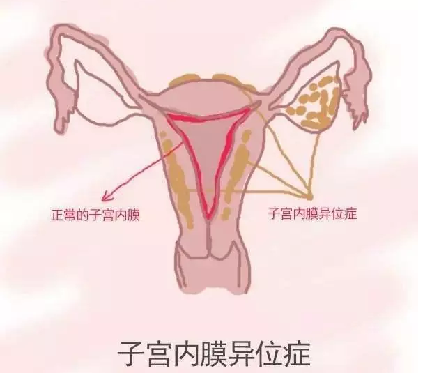 重庆送子鸟医院